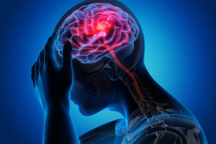 What Are The Causes Of Having A Stroke At A Young Age?